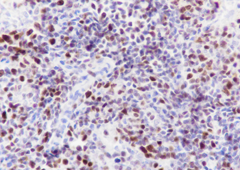 EZH2 Recombinant Rabbit Monoclonal Antibody