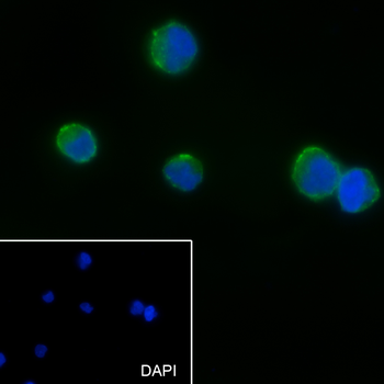 CD19 Recombinant Rabbit Monoclonal Antibody