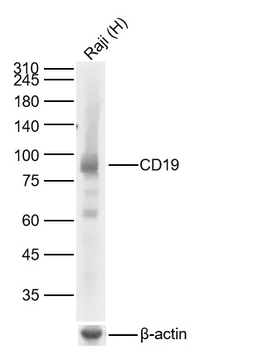 CD19 Recombinant Rabbit Monoclonal Antibody