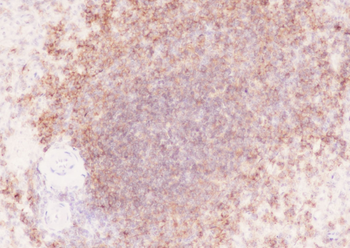 CD19 Recombinant Rabbit Monoclonal Antibody