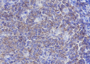 CD19 Recombinant Rabbit Monoclonal Antibody