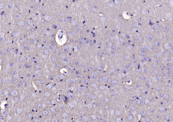 SNAP25 Recombinant Mouse Monoclonal Antibody