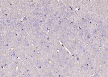 SNAP25 Recombinant Mouse Monoclonal Antibody
