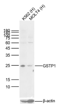 GSTP1 Recombinant Rabbit Monoclonal Antibody