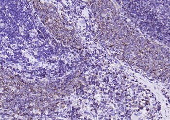 CD79b Recombinant Rabbit Monoclonal Antibody