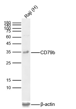 CD79b Recombinant Rabbit Monoclonal Antibody