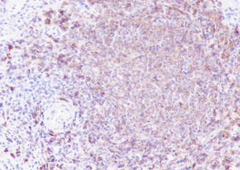 CD79b Recombinant Rabbit Monoclonal Antibody