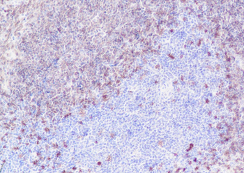 CD79b Recombinant Rabbit Monoclonal Antibody