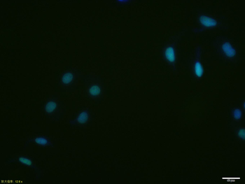 XRCC5/Ku80 Recombinant Rabbit Monoclonal Antibody