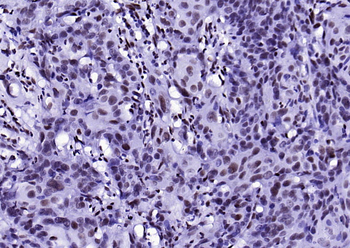 XRCC5/Ku80 Recombinant Rabbit Monoclonal Antibody