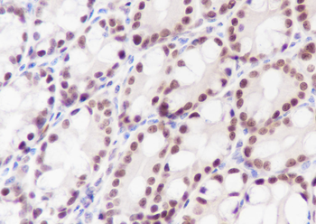 XRCC5/Ku80 Recombinant Rabbit Monoclonal Antibody