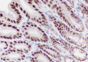 XRCC5/Ku80 Recombinant Rabbit Monoclonal Antibody