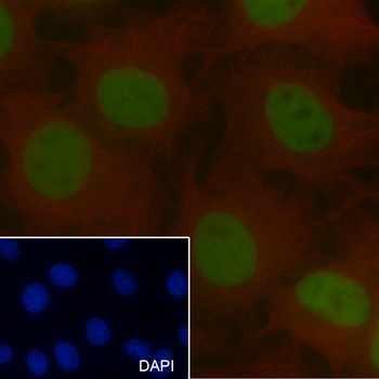 MSH6 Recombinant Rabbit Monoclonal Antibody