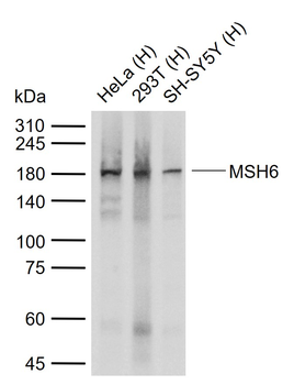 MSH6 Recombinant Rabbit Monoclonal Antibody