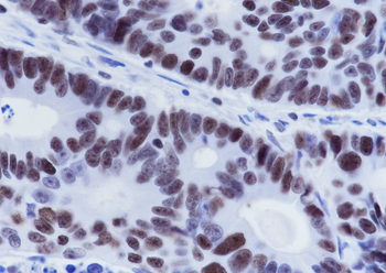 MSH6 Recombinant Rabbit Monoclonal Antibody