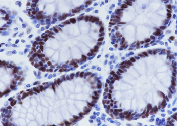 MSH6 Recombinant Rabbit Monoclonal Antibody