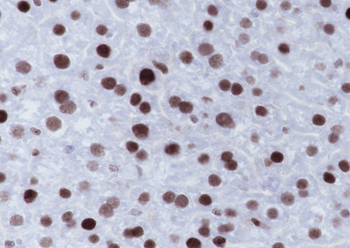 MSH6 Recombinant Rabbit Monoclonal Antibody