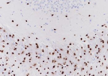 SOX-10 Recombinant Rabbit Monoclonal Antibody