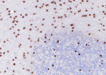 SOX-10 Recombinant Rabbit Monoclonal Antibody