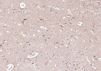 STMN1 Recombinant Rabbit Monoclonal Antibody