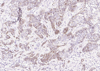 STMN1 Recombinant Rabbit Monoclonal Antibody