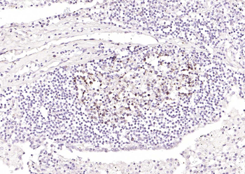 STMN1 Recombinant Rabbit Monoclonal Antibody