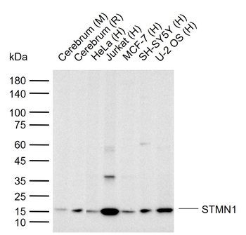 STMN1 Recombinant Rabbit Monoclonal Antibody