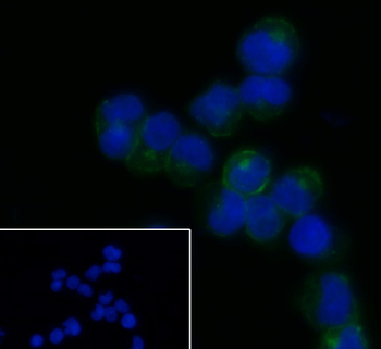 CD21 Recombinant Rabbit Monoclonal Antibody