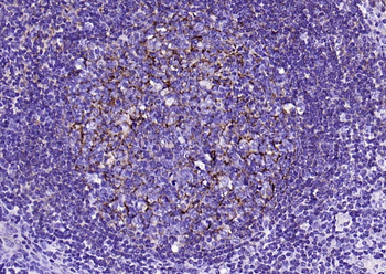 CD21 Recombinant Rabbit Monoclonal Antibody