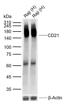 CD21 Recombinant Rabbit Monoclonal Antibody