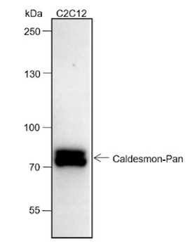 Caldesmon Recombinant Rabbit Monoclonal Antibody