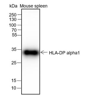 HLA-DPA1 Recombinant Rabbit Monoclonal Antibody