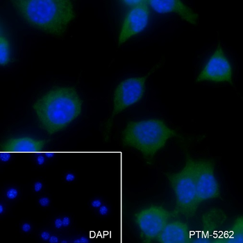 HLA-DPA1 Recombinant Rabbit Monoclonal Antibody
