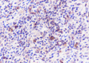 HLA-DPA1 Recombinant Rabbit Monoclonal Antibody