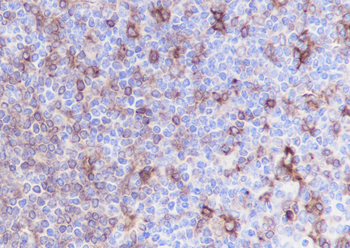 HLA-DPA1 Recombinant Rabbit Monoclonal Antibody