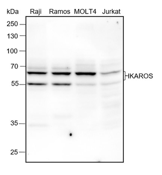 IKZF1 Recombinant Rabbit Monoclonal Antibody