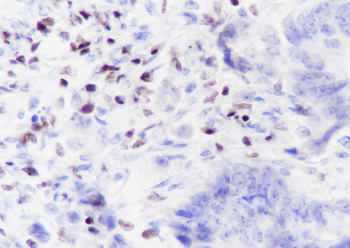 IKZF1 Recombinant Rabbit Monoclonal Antibody