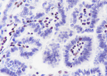 IKZF1 Recombinant Rabbit Monoclonal Antibody