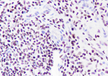 IKZF1 Recombinant Rabbit Monoclonal Antibody