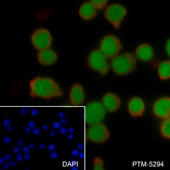 SATB1 Recombinant Rabbit Monoclonal Antibody