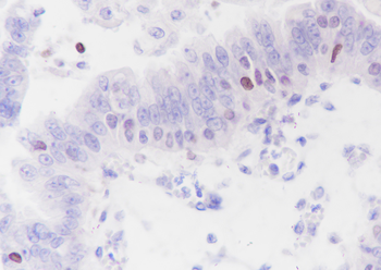 SATB1 Recombinant Rabbit Monoclonal Antibody