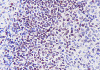 SATB1 Recombinant Rabbit Monoclonal Antibody