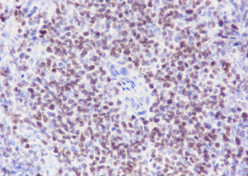 SATB1 Recombinant Rabbit Monoclonal Antibody