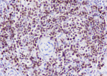 SATB1 Recombinant Rabbit Monoclonal Antibody