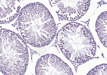 Phospho-GSK-3 Beta (Ser9) Mouse Monoclonal Antibody