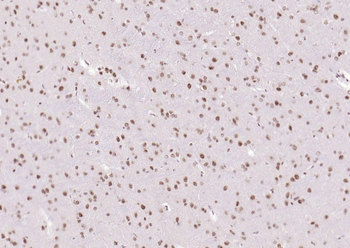 Phospho-GSK-3 Beta (Ser9) Mouse Monoclonal Antibody