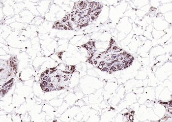 Phospho-GSK-3 Beta (Ser9) Mouse Monoclonal Antibody