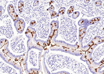 MUC2 Recombinant Rabbit Monoclonal Antibody