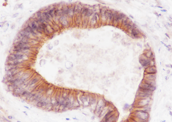 FGFR2 Recombinant Rabbit Monoclonal Antibody