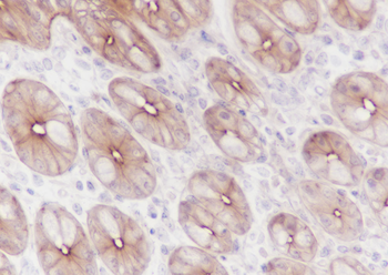 FGFR2 Recombinant Rabbit Monoclonal Antibody